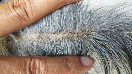 You are currently viewing Dog Lice: Signs, Causes, and How to Treat Them
